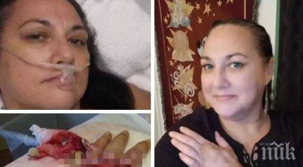 коварен вирус леко порязване уби американка