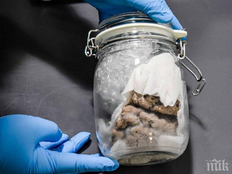 ПОТРЕСАВАЩО: Заловиха човешки мозък в буркан на граничен пункт