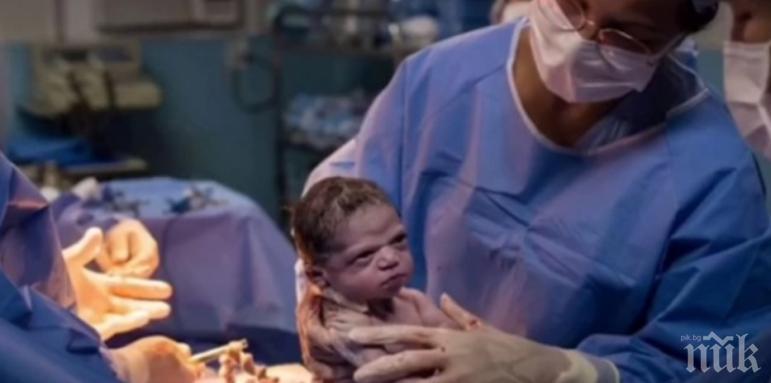 ШОК: Изродиха най-намръщеното бебе