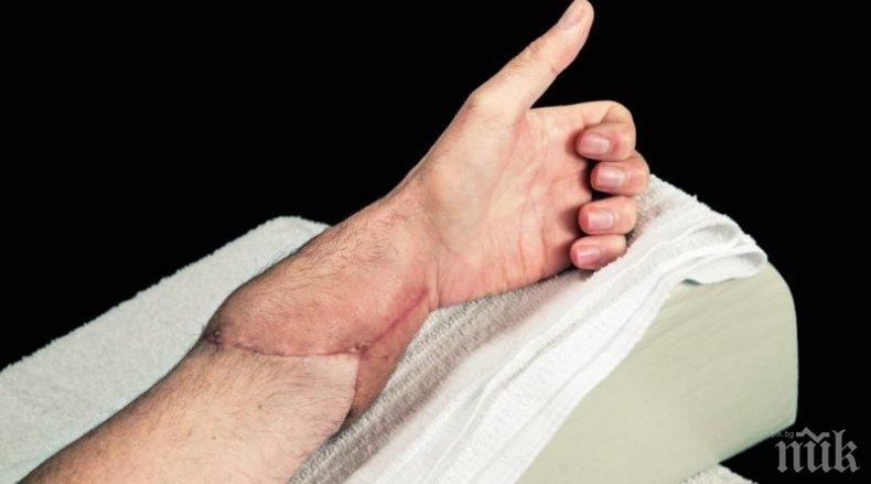 НЕВЕРОЯТО: Във Виетнам трансплантираха ръка от жив донор