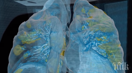 виртуална реалност сензационно видео показва covid превзема белите дробове