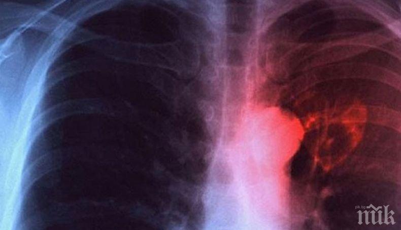 Отбелязваме Световният ден за борба с туберкулозата