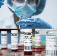 Починалите от коронавирус в Швейцария вече са 559