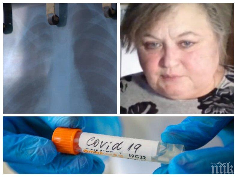 БИТКА СЪС ЗАРАЗАТА: Проговори излекувана от коронавирус 67-годишна пациентка на Пирогов, жената е с диабет...