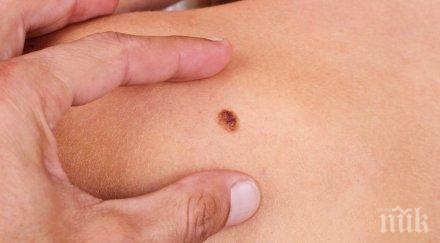 притесни бенка