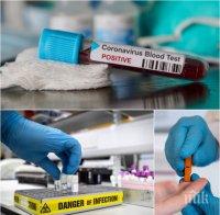  Доналд Тръмп се надавя в САЩ скоро да правят по 400 000 теста за коронавирус дневно

 