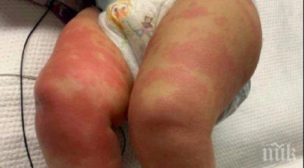 мистерия болест наподобяваща коронавируса убива деца великобритания