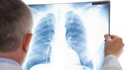 лекари измененията белия дроб пациенти covid типа матово стъкло
