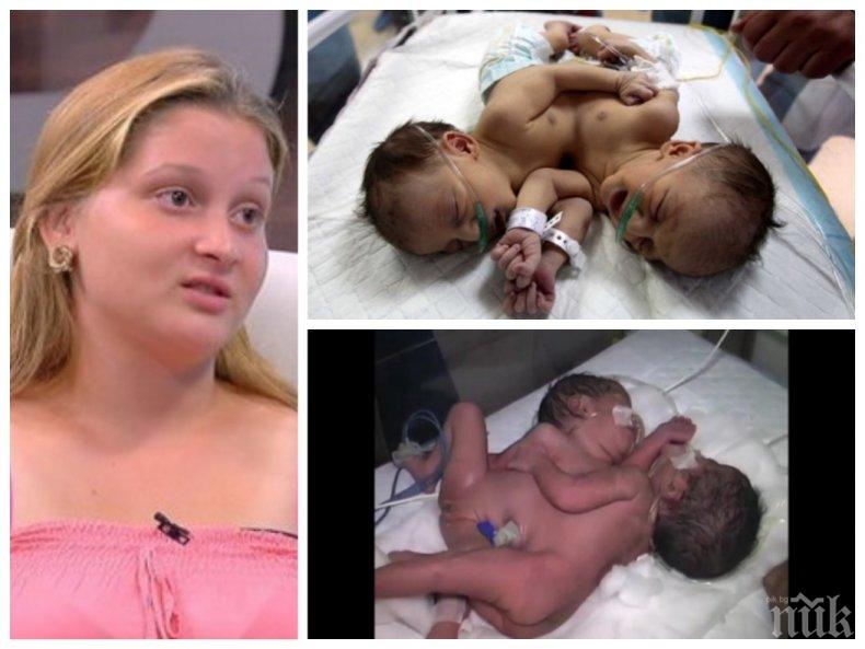 КАЗУС: Циганката, родила сиамски близнаци от братовчед си, чака пари от държавата, за да ги раздели