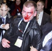 Атентаторът на Доган изпробвал оръжието си при заря, още тогава засякло