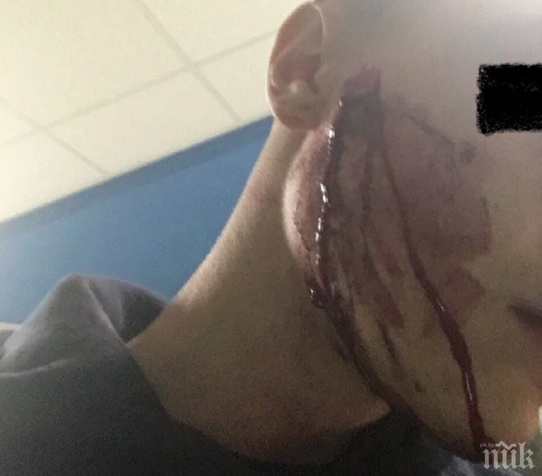 МВР откри дисциплинарно производство срещу полицай, намушкал 16-годишен фен на Локо (Пд)