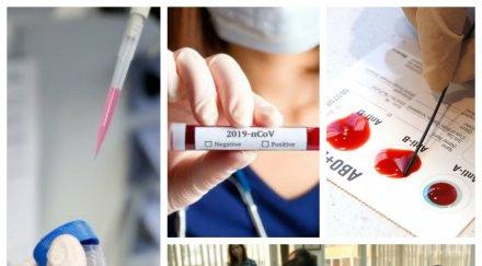 гореща новина учените категорични кръвната група играе ключова роля протече заболяването covid