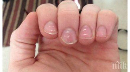 внимание петната ноктите опасни