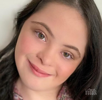 18-годишна красавица със синдрома на Даун стана модел на 