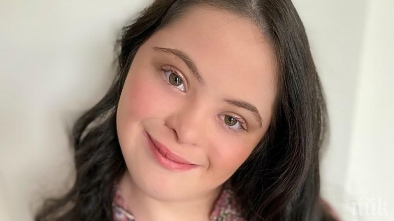 18-годишна красавица със синдрома на Даун стана модел на Гучи