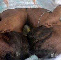 Успешно разделиха сиамски близначки в Италия 