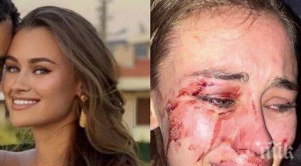 екшън украински топ модел отнесе здрав бой плаж турция оказа