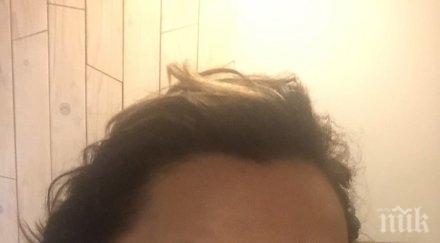 жена пострада тежко дерматолог поставяне конци лицето снимки документи