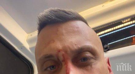 Кръвта на Георги Флоров оцапа Румен Радев. Българин е пребит по политически причини