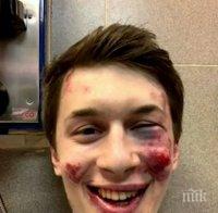 Брутално: Блогър и критик на Кремъл е нападнат и пребит в Москва