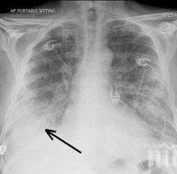 БАБХ и НЦЗПБ съвместно проучват разпространението на Ку-треска сред рискови групи
