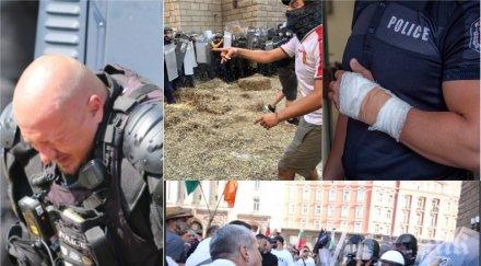 горещо пик агитки готвят леят кръв тъмно полицията службите крак снимки