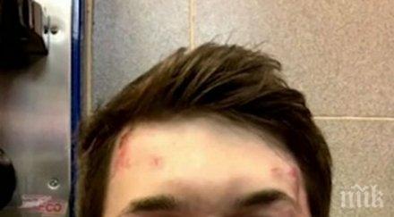 брутално блогър критик кремъл нападнат пребит москва