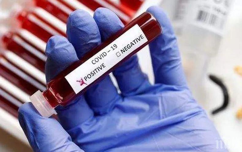 ТРАГЕДИЯ! 40-годишен мъж загуби битката с COVID-19 - няма данни за други заболявания