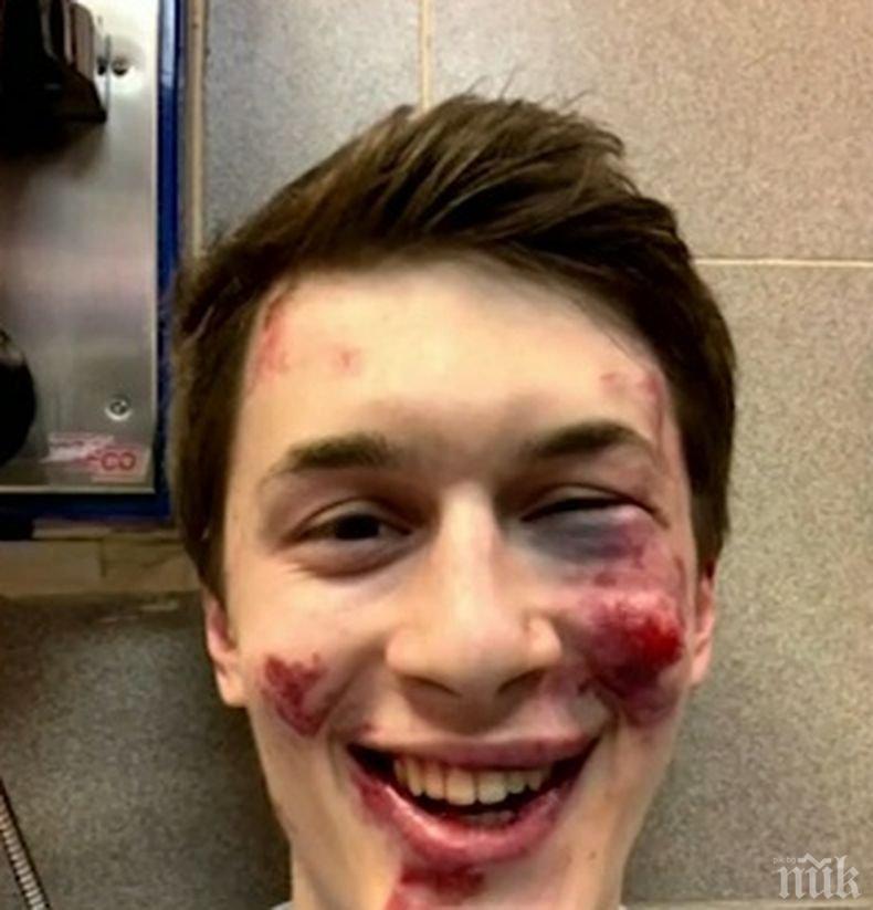 Брутално: Блогър и критик на Кремъл е нападнат и пребит в Москва