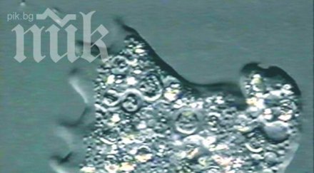 амеба изяде мозъка годишно дете