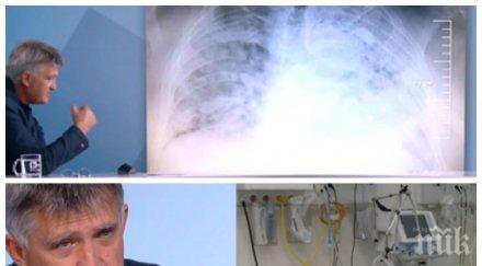 проф николай младенов стряскащи данни заразата агресивна нанася големи поражения белия дроб