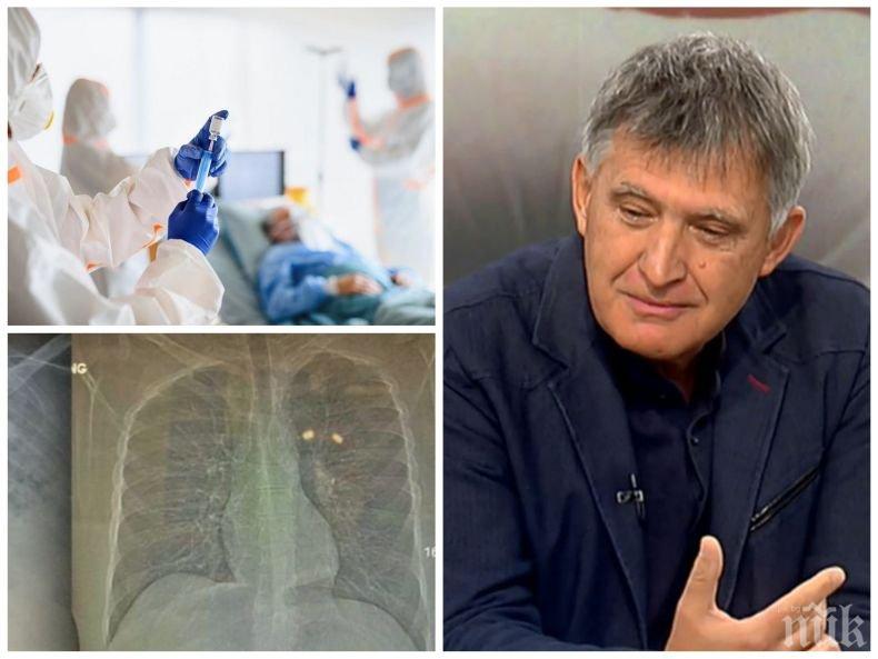 Проф. Николай Младенов с важно предупреждение за пандемията - какви ужасяващи поражения нанася тя върху белия дроб