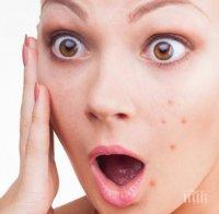 Кои храни повишават риска от акне