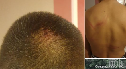 пребиха ритници дете северния парк отмъкнаха колелото