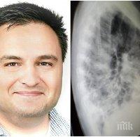 ШОКИРАЩО: Български лекар в Германия показа СНИМКИ на белите дробове на интубиран пациент с коронавирус и разкри, че IQ-то на заразените пада заради болестта