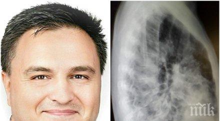 шокиращо български лекар германия показа снимки белите дробове интубиран пациент коронавирус разкри заразените пада заради болестта