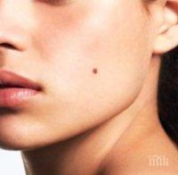 бенките лицето разкриват съдбата