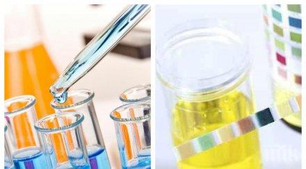 сензационно нов тест урина открива коронавируса секунди