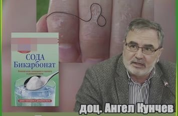 Вкараха Ангел Кунчев в шарлатания срещу паразити