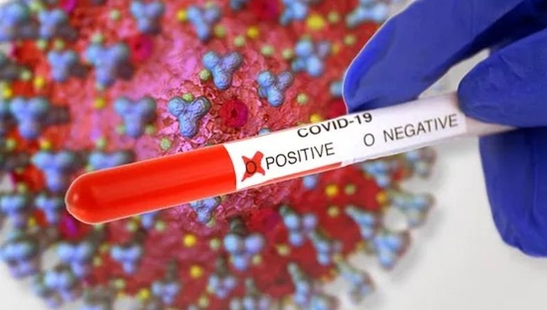 В Русия е засечен южноафриканаският вариант на коронавируса