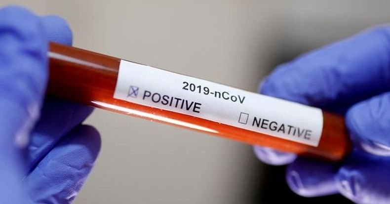 Чехия е с най-високи показатели по смъртност от COVID-19 в света