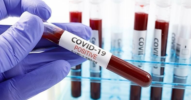 Над 3 300 новозаразени с коронавируса в Канада за денонощие