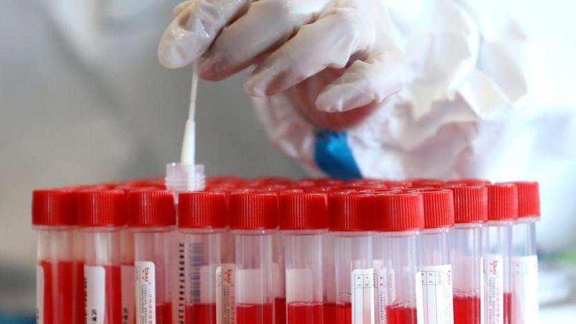 Виена предлага безплатни PCR тестове, които да се правят в магазините и бензиностанциите