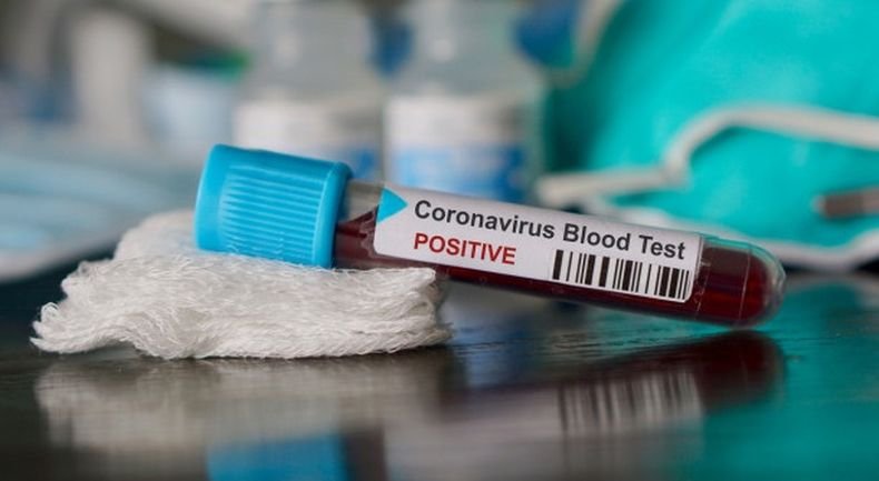 Над 30 млн. са вече случаите на коронавирус в САЩ