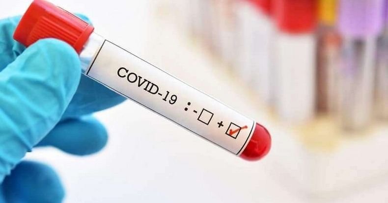 Първо в ПИК: 2944 новозаразени с коронавирус