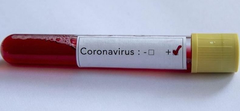 Над 16 400 новозаразени с коронавируса в Колумбия за денонощие