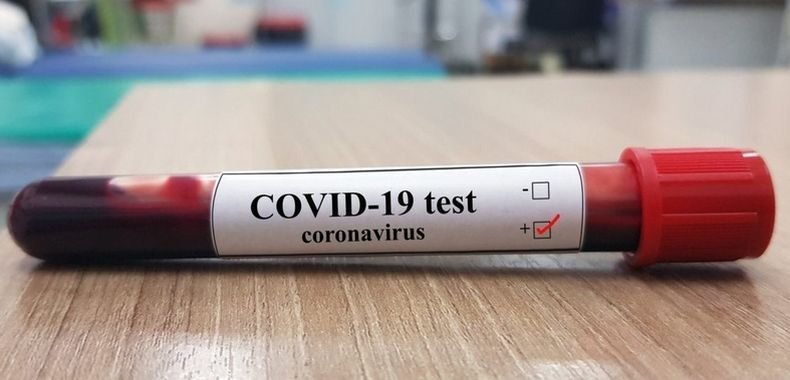 Над 73 500 новозаразени с коронавируса в Бразилия за денонощие