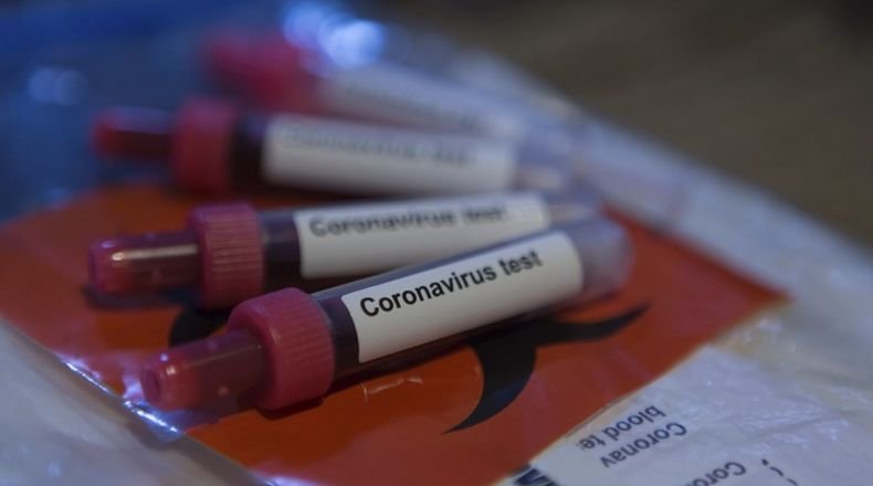 Над 16 100 новозаразени с коронавируса в Италия за денонощие
