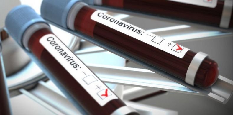 Над 15 800 новозаразени с коронавируса в Колумбия за денонощие