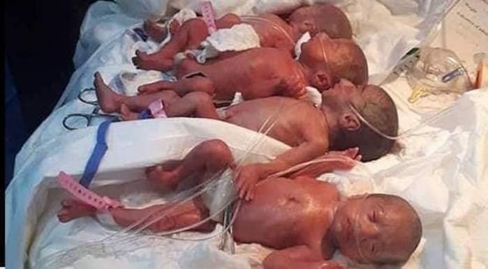Жена от Мали роди девет бебета